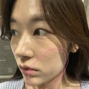 아로美피부관리실 | 마곡 피부관리 희아로움 마곡본점 여드름부터 신부관리까지