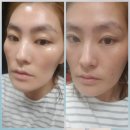 리모사 | 효과/인셀덤화장품/인셀덤후기/리포브후기/리포브/리모사/성형화장품/리모사후기/인셀덤/인싸화장품/꿀...