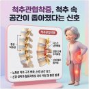 수지구청역서울탑본의원 네이버블로그