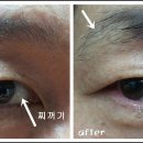 남51 Daum카페