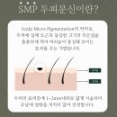 엘리시아3차 | 동탄 smp로 자연스러운 두피 변화! 동탄 탈모치료는 모두리SMP가 답이다