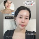 황무로 | 이천 피부관리 리본뷰티 증포동 임산부 에스테틱 수분 물광 케어 리얼 후기