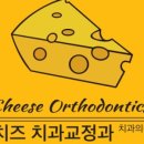 치즈치과교정과치과의원 네이버블로그
