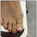 맑은이비인후과의원 | 아빠 발톱무좀 치료로 방문한 맑은소리이비인후과 후기 😋