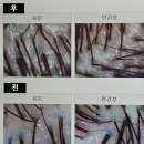 탑스칼프 평내호평점 | 남양주 두피관리, 탑스칼프평내호평점에서 복합성 두피관리+케어 받은 자세한 후기