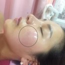 삼안로R | 김해 피부관리 , 빈스뷰티에서 인제대 피부관리 제대로 ♩