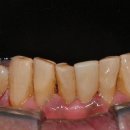 서울좋은치과보철과치과의원 이미지