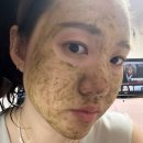 청담비비약국 | 성분에디터 약초샷 내돈내산 좁쌀여드름 후기