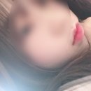 지옥의 구순염 마지막편 총정리(구순염 완치, 틴트, 치약, 병원, 엘리델 효과)