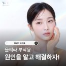 브이앤엠제이(V&MJ)피부과의원 | 울쎄라 시술 후 장기 부작용은 무엇이 있나요?