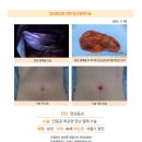 담낭종괴수술후기. 친절하고 상세한 설명으로 안정감있는 진료해주셨고 수술도 잘해주셨습니다. 이미지