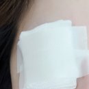 홍안과의원 | 내돈내시술: 침산동 홍안과 다래끼수술 후기