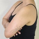 카왁싱프로젝트 | 콤플렉스 팔뚝살 뿌시기 지방추출주사 준비,주의사항,통증 생생후기 부천다이어트클리닉
