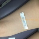 셀렉트피부과의원 네이버블로그