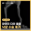 낙상 | 사당 동물병원 강아지 다리 골절, 낙상 수술 후기