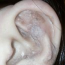 귀 건강학(이혈테라피) 이미지