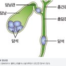 &#34;송어 날로 먹지 마세요&#34;…한국 전세계 사망률 1위인 &#39;이 암&#39; 이미지