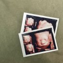 루미산부인과의원 | [임신 일기] 27주차 입체초음파 후기/ 리베르 여성병원/ 영통 산부인과 추천