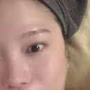 해운대 메디칼 | |부산 해운대 라라뷰티, lalabeauty| 해운대피부이벤트로 받은 셀린브리티 후기