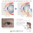 새봄안과 이미지