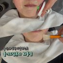 김밥천국화봉점 | 울산재생관리잘하는곳 트러블 심할 때 받아본 재생관리 솔직후기