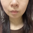 진정케어 화장품 아쿠아크 리프레쉬 비건 아크라인 세트