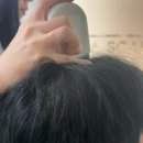 아모로 | 제주 아모로 탈모 두피클리닉 에서 예비신랑 탈모관리 리얼후기
