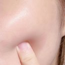 스킨온도 이미지