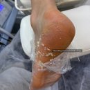 하얀운동화빨래방 | 인천 발관리, 아기 발로 다시 태어난 “레푸스 부평역점” 솔직후기