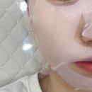 내돈내산 쁨에스테틱 추천 | 화농성&좁쌀 여드름 대전 관저동 피부관리실 찐 효과 공유 후기