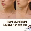 [서울/송파] N회차 잠실새내경락 위뷰티잠실점 리프팅 후기