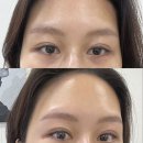 뷰티101 | 부평왁싱 잘하는 곳 추천 • 부평속눈썹펌 • 101뷰티 부평 • 풀패키지 후기