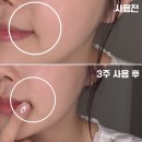 홈케어 디바이스 추천템_메디큐브 하이포커스샷 솔직후기, 사용법! 피부 탄력 꿀조합 추천_부스터프로