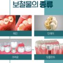 디자인탑치과기공소 이미지