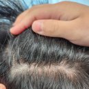 스토어솔루션 | 지루성두피샴푸 이스터스칼프솔루션 비듬샴푸 두피샴푸 리얼후기