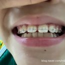 슈어치과교정과치과병원 이미지