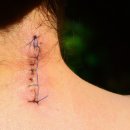 김앤박차이의원 이미지