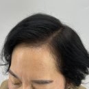 픽스칼프 이미지