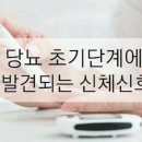 당뇨 초기 단계에 발견되는 신체 신호 5 이미지