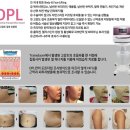 디피엘 이미지