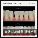 뉴엔치과의원 네이버블로그