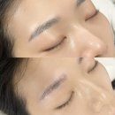 주안약국 | 주안 반영구 눈썹 상담 잔흔 완화 바이른