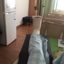 최경진정형외과의원 | 무지외반증 최경진정형외과 내친구의 수술 후기