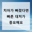 태미안 치과의원 | 중랑구치과 치아가 빠졌다면 빠른 대처가 중요해요