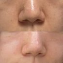 도도독B | 제대로 하는 맞춤형 피부관리샵. 부산 센텀 피부관리 뷰티여은