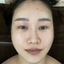화곡역 피부관리 소현결에스테틱 웨딩관리 추천