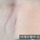 어제모했어슈가왁싱