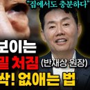 눈밑 처짐 없애는 법(원장 이미지