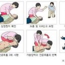 심장마비 전조 원인과 예방 이미지