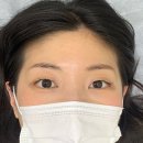 일산근린공원 화장실 | 일산 잔흔제거 더블랙라인 일산눈썹&amp;속눈썹 붉은눈썹 제거후기